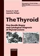 The Thyroid: Fine-Needle Biopsy and Cytological Diagnosis of Thyroid Lesions