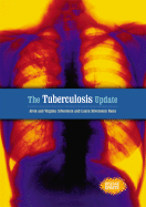 The Tuberculosis Update