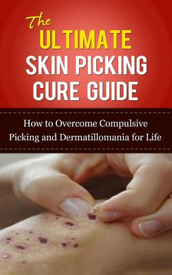 The Ultimate Skin Picking Cure Guide: How to Overcome Compulsive Picking and Dermatillomania for Life - Lincoln, Caesar