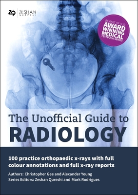 The Unofficial Guide to Radiology: 100 Practice Orthopaedic X Rays with Full Colour Annotations and Full X Ray Reports - Gee, Christopher, and Young, Alexander, and Rodrigues, Mark A