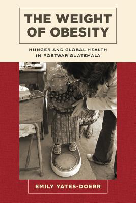 The Weight of Obesity: Hunger and Global Health in Postwar Guatemala Volume 57 - Yates-Doerr, Emily