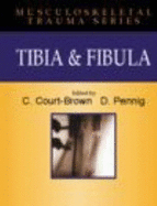 Tibia & Fibia