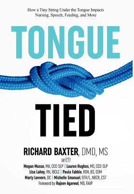 Tongue-Tied: How a Tiny String Under the Tongue Impacts Nursing, Speech, Feeding, and More - Baxter, DMD Richard, Ms., and Musso, Ma CCC-Slp Megan (Contributions by), and Hughes, CCC-Slp Lauren, Ms. (Contributions by)