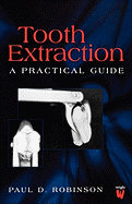 Tooth Extraction: A Practical Guide