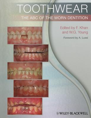 Toothwear: The ABC of the Worn Dentition - Khan, Farid (Editor), and Young, William G. (Editor), and Lussi, Adrian (Foreword by)