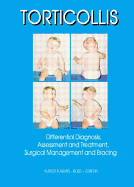 Torticollis: Differential Diagnosis, Assessment and Treatment, Surgical Management and Bracing