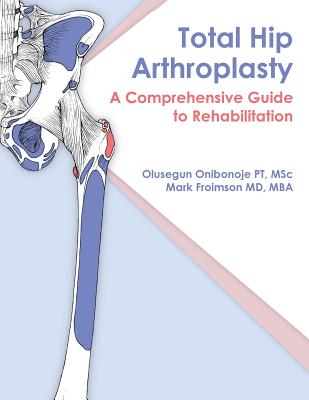 Total Hip Arthroplasty: A Comprehensive Guide to Rehabilitation - Froimson, Mark