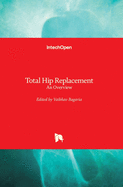 Total Hip Replacement: An Overview