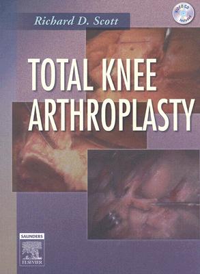 Total Knee Arthroplasty - Scott, Richard D, MD