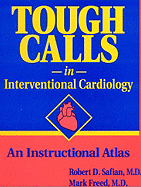 Tough Calls in Interventional Cardiology