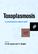 Toxoplasmosis: A Comprehensive Clinical Guide