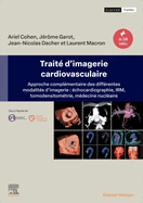 Trait? d'Imagerie Cardiovasculaire: Approche Compl?mentaire Des Diff?rentes Modalit?s d'Imagerie: ?chocardiographie, Irm, Tomodensitom?trie, M?decine Nucl?aire