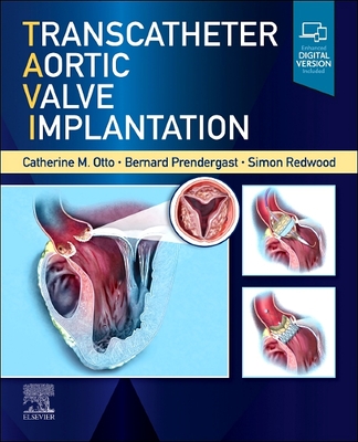 Transcatheter Aortic Valve Implantation - Otto, Catherine M, MD (Editor), and Prendergast, Bernard D, MD (Editor), and Redwood, Simon, MD (Editor)
