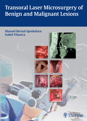 Transoral Laser Microsurgery of Benign and Malignant Lesions - Bernal-Sprekelsen, Manuel (Editor), and Vilaseca, Isabel (Editor)