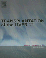 Transplantation of the Liver - Busuttil, Ronald W, and Klintmalm, Goran B, MD, PhD, Facs