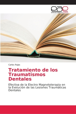 Tratamiento de los Traumatismos Dentales - Rojas, Carlos