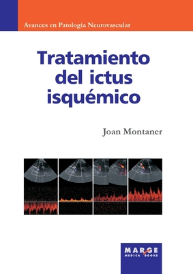 Tratamiento del ictus isqu?mico - Montaner, Joan