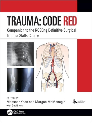 Trauma: Code Red: Companion to the Rcseng Definitive Surgical Trauma Skills Course - Khan, Mansoor (Editor), and McMonagle, Morgan (Editor)