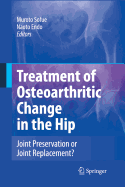 Treatment of Osteoarthritic Change in the Hip: Joint Preservation or Joint Replacement?