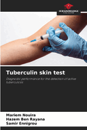 Tuberculin skin test