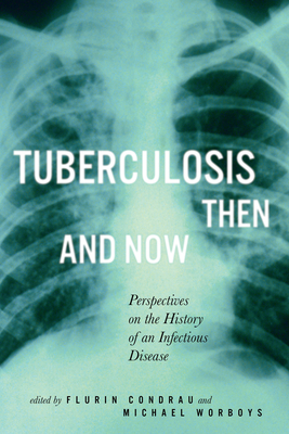 Tuberculosis Then and Now: Perspectives on the History of an Infectious Disease Volume 36 - Condrau, Flurin, and Worboys, Michael