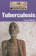 Tuberculosis