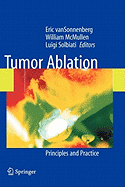 Tumor Ablation: Principles and Practice