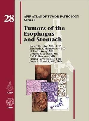 Tumors of the Esophagus and Stomach - Odze, Robert D., and Montgomery, Elizabeth A., and Wang, Helen H.