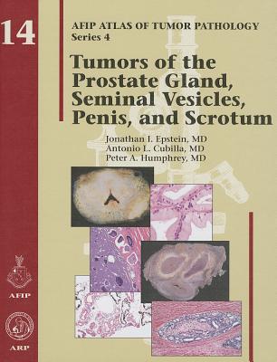 Tumors of the Prostate Gland, Seminal Vesicles, Penis, and Scrotum - Young, Robert H., and Srigley, John R., and Amin, Mahul B.