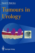 Tumours in Urology