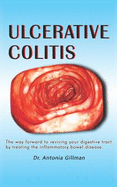 Ulceratlve Colltls: A Way Forward to Reviving Your Digestive Tract by Treating the Inflammatory Bowel Disease