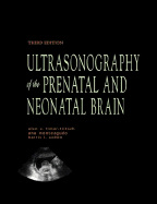 Ultrasonography of the Prenatal & Neonatal Brain