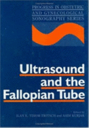 Ultrasound and the Fallopian Tube