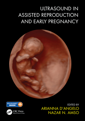 Ultrasound in Assisted Reproduction and Early Pregnancy - D'Angelo, Arianna (Editor), and Amso, Nazar N. (Editor)