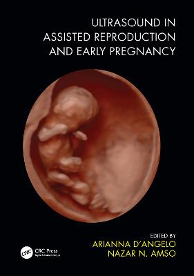 Ultrasound in Assisted Reproduction and Early Pregnancy - D'Angelo, Arianna (Editor), and Amso, Nazar N (Editor)