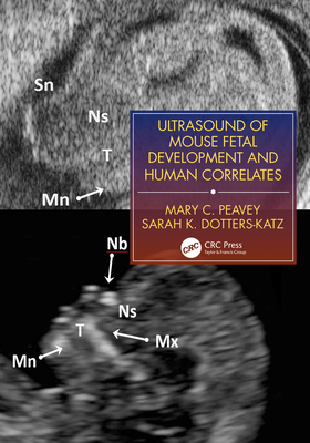 Ultrasound of Mouse Fetal Development and Human Correlates - Peavey, Mary C., and Dotters-Katz, Sarah K.