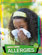 Understanding Allergies