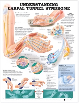 Understanding Carpal Tunnel Syndrome Anatomical Chart - Anatomical Chart Company (Prepared for publication by)