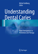 Understanding Dental Caries: From Pathogenesis to Prevention and Therapy