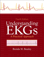 Understanding EKGs: A Practical Approach