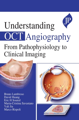 Understanding OCT Angiography: From Pathophysiology to Clinical Imaging - Lumbroso, Bruno, and Huang, David, and Souied, Eric H