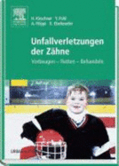 Unfallverletzungen Der Zhne: Vorbeugen-Retten-Behandeln