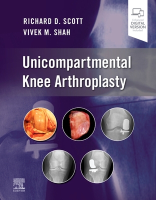 Unicompartmental Knee Arthroplasty - Scott, Richard D, and Shah, Vivek