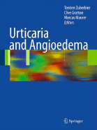 Urticaria and Angioedema