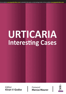 Urticaria: Interesting Cases