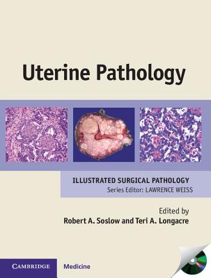 Uterine Pathology - Soslow, Robert A., M.D., and Longacre, Teri A., M.D.