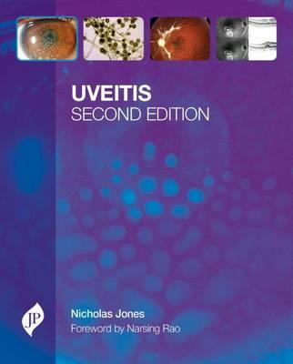 Uveitis - Jones, Nicholas P