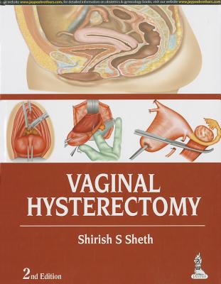 Vaginal Hysterectomy - Sheth, Shirish S