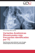 Variantes Anatomicas Rinosinusales Mas Frecuentes Identificadas Por Tc