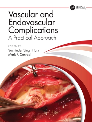 Vascular and Endovascular Complications: A Practical Approach - Hans, Sachinder Singh (Editor), and Conrad, Mark F (Editor)